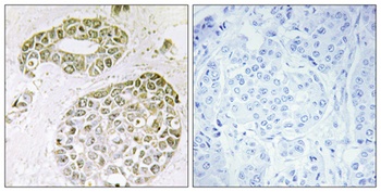 hnRNP M rabbit pAb Antibody