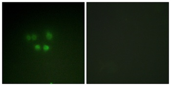 Nibrin rabbit pAb Antibody