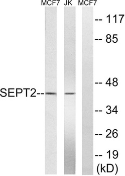 Septin 2 rabbit pAb Antibody