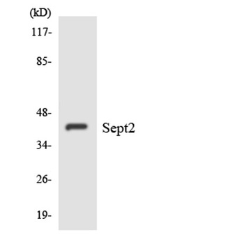 Septin 2 rabbit pAb Antibody