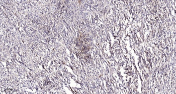 Septin 2 rabbit pAb Antibody