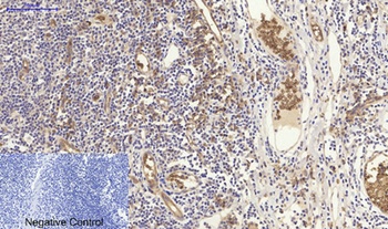 NFκB-p105/p50 rabbit pAb Antibody