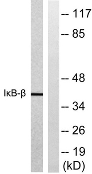 IκB-β rabbit pAb Antibody