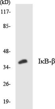 IκB-β rabbit pAb Antibody