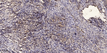IκB-β rabbit pAb Antibody