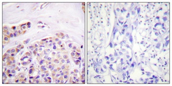 IκB-ε rabbit pAb Antibody