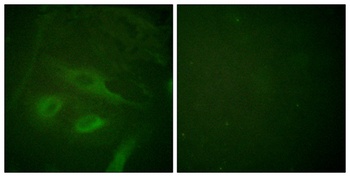 IκB-ε rabbit pAb Antibody