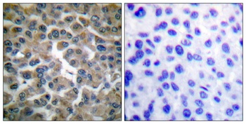 IκB-ε rabbit pAb Antibody