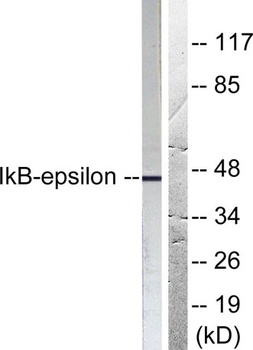 IκB-ε rabbit pAb Antibody