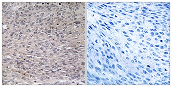 IRP-1 (phospho Ser711) rabbit pAb Antibody