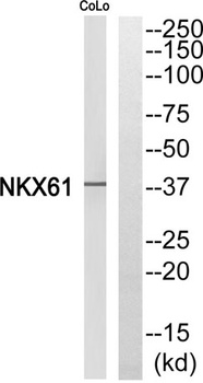 Nkx-6.1 rabbit pAb Antibody