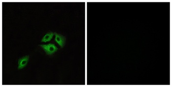 NMBR rabbit pAb Antibody