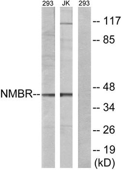 NMBR rabbit pAb Antibody