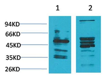 NMBR rabbit pAb Antibody