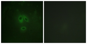 NOS1 (phospho Ser852) rabbit pAb Antibody