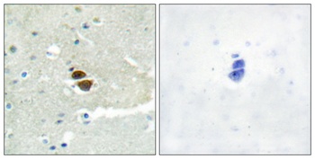NOS1 (phospho Ser852) rabbit pAb Antibody