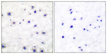Trk A rabbit pAb Antibody