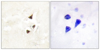 Trk B (phospho Tyr516) rabbit pAb Antibody