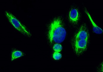 Trk B rabbit pAb Antibody