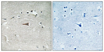 DOR-1 (phospho Ser363) rabbit pAb Antibody