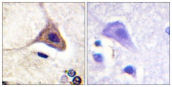 DOR-1 (phospho Ser363) rabbit pAb Antibody