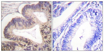 PAKγ (phospho Ser20) rabbit pAb Antibody