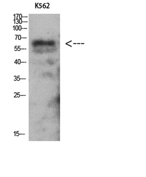 AMPKγ2 rabbit pAb Antibody