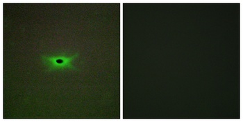 AMPKγ2 rabbit pAb Antibody