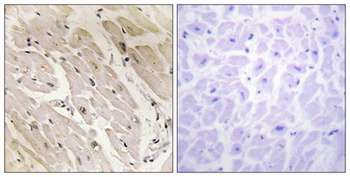 AMPKγ2 rabbit pAb Antibody