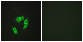 ARMCX3 rabbit pAb Antibody