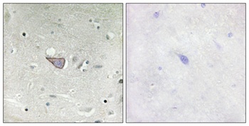 ARMCX3 rabbit pAb Antibody