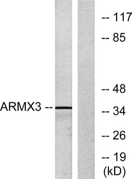 ARMCX3 rabbit pAb Antibody