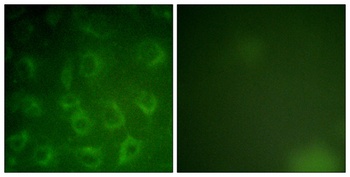 PDGFR-β rabbit pAb Antibody