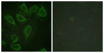 CD31 (phospho Tyr713) rabbit pAb Antibody
