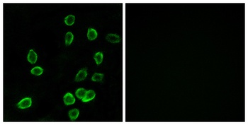 ATP5G3 rabbit pAb Antibody