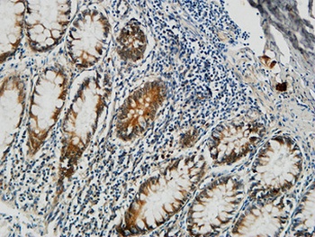 PGD rabbit pAb Antibody