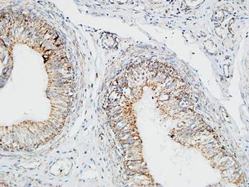Pin1 rabbit pAb Antibody