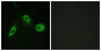 PLC γ2 (phospho Tyr1217) rabbit pAb Antibody