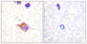PLC γ2 (phospho Tyr1217) rabbit pAb Antibody