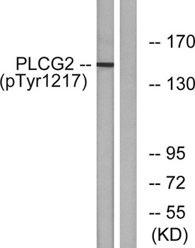 PLC γ2 (phospho Tyr1217) rabbit pAb Antibody