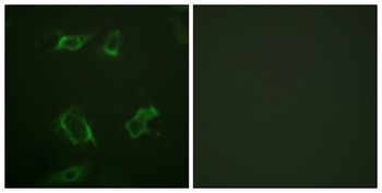 PC-PLD1 (phospho Ser561) rabbit pAb Antibody