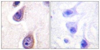 PC-PLD1 (phospho Ser561) rabbit pAb Antibody