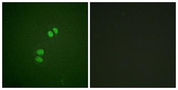 Plk rabbit pAb Antibody