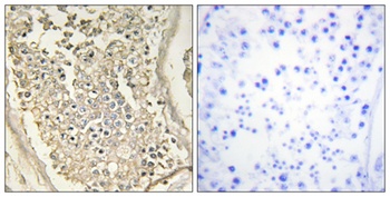 ATP7B rabbit pAb Antibody