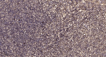 Septin 5 rabbit pAb Antibody