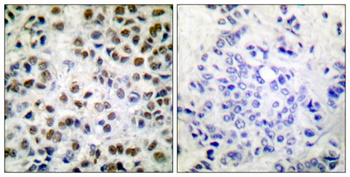 Rpb1 (phospho Ser1619) rabbit pAb Antibody