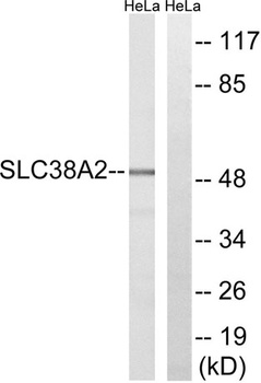 SNAT2 rabbit pAb Antibody