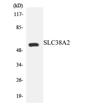 SNAT2 rabbit pAb Antibody