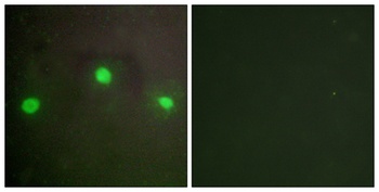 ATRX rabbit pAb Antibody