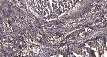 mPRγ rabbit pAb Antibody